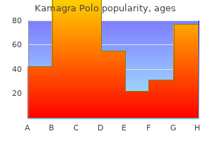 order kamagra polo 100mg mastercard