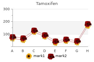 tamoxifen 20mg on-line