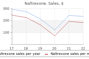 cheap 50 mg naltrexone visa